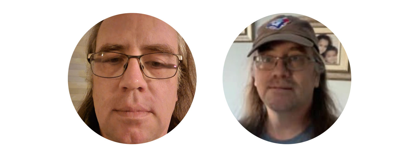 Todd Vernon before and after for Movember